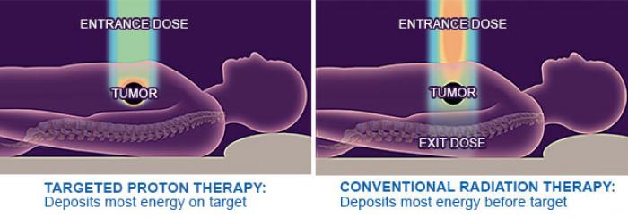 Is this it? Has the cure for cancer been found? New proton