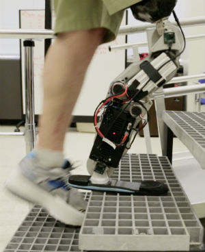 Mind-controlled bionic leg heralded as breakthrough - Health & Wellness ...